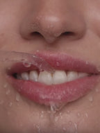 HydrAdent™